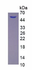 Recombinant Dickkopf Related Protein 1 (DKK1)