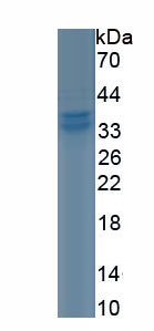 Recombinant Programmed Cell Death Protein 1 (PD1)