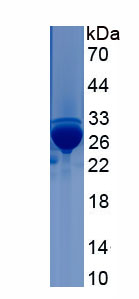 Recombinant Myosin Heavy Chain 1 (MYH1)