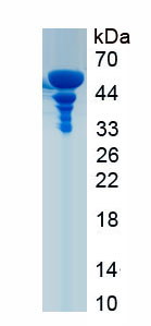 Recombinant Myosin Heavy Chain 2 (MYH2)