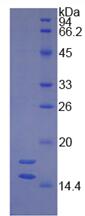 Recombinant Forkhead Box Protein C1 (FOXC1)