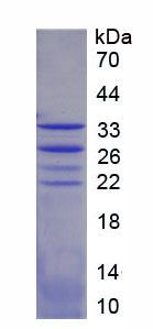 Recombinant Forkhead Box Protein O1 (FOXO1)