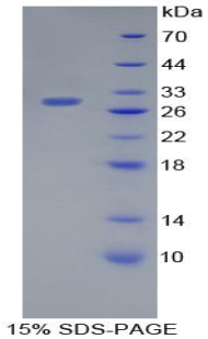 Recombinant Podocalyxin (PODXL)