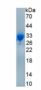 Recombinant Lipase, Hepatic (LIPC)