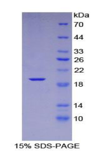 Recombinant Chemokine C-X-C-Motif Ligand 16 (CXCL16)