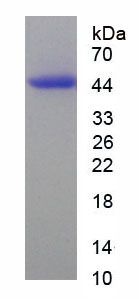 Recombinant Pyruvate dehydrogenase alpha 1 (PDHA1)