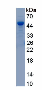 Recombinant Pyruvate dehydrogenase alpha 1 (PDHA1)
