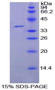 Recombinant Lactoferrin (LTF)