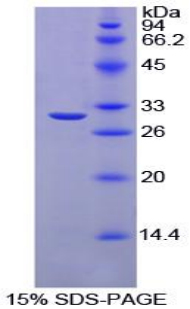 Recombinant Carbonic Anhydrase II (CA2)