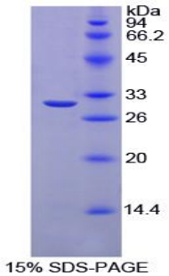 Recombinant Carbonic Anhydrase II (CA2)