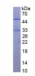 Recombinant Complement Factor P (CFP)