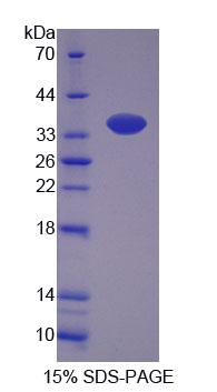 Recombinant Kidney Injury Molecule 1 (Kim1)