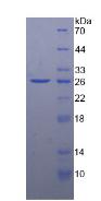 Recombinant Ficolin 1 (FCN1)