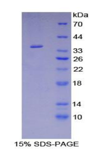 Recombinant Ficolin 1 (FCN1)