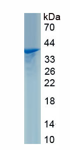 Recombinant Programmed Cell Death Protein 1 Ligand 1 (PDL1)