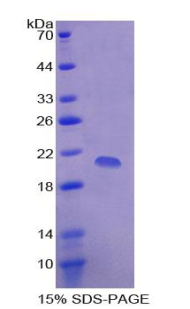 Recombinant Cyclin Dependent Kinase Inhibitor 2A (CDKN2A)