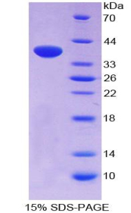 Recombinant Neuropeptide S (NPS)