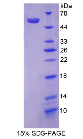 Recombinant Angiotensinogen (AGT)