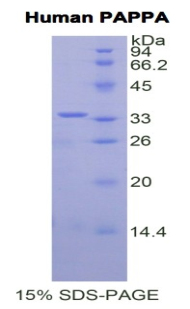 Recombinant Pregnancy Associated Plasma Protein A (PAPPA)