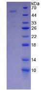 Recombinant Pregnancy Associated Plasma Protein A (PAPPA)