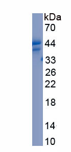 Recombinant Pregnancy Associated Plasma Protein A (PAPPA)