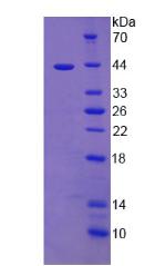 Recombinant Cholecystokinin (CCK)