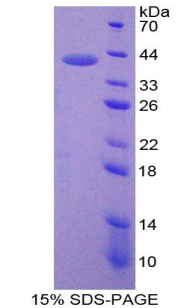 Recombinant Neuromedin B (NMB)