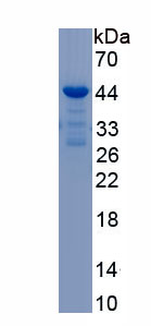 Recombinant Neuromedin B (NMB)