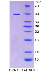 Recombinant Tumor Necrosis Factor Receptor Superfamily, Member 12A (TNFRSF12A)