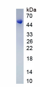 Recombinant Alpha-1-Acid Glycoprotein (a1AGP)