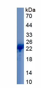 Recombinant Alpha-1-Acid Glycoprotein (a1AGP)