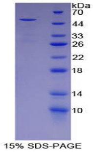 Recombinant Alpha-1-Acid Glycoprotein (a1AGP)