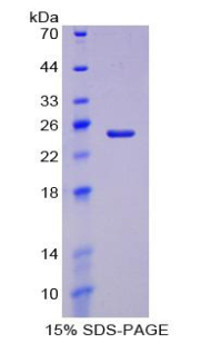 Recombinant Haptoglobin (Hpt)