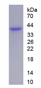 Recombinant Death receptor 5 (DR5)