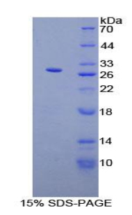 Recombinant Parathyroid Hormone Related Protein (PTHrP)