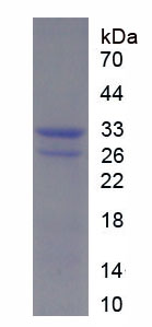 Recombinant Parathyroid Hormone Related Protein (PTHrP)