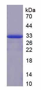 Recombinant Coagulation Factor II (F2)