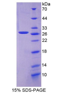 Recombinant C Reactive Protein (CRP)