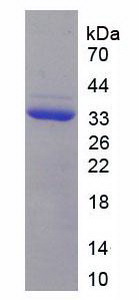 Recombinant C Reactive Protein (CRP)