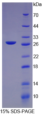 Recombinant C Reactive Protein (CRP)