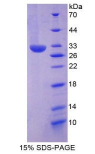 Recombinant Heat Shock Protein 60 (Hsp60)