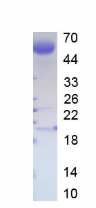 Recombinant Heat Shock Protein 90kDa Beta 1 (HSP90b1)