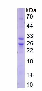 Recombinant Cluster Of Differentiation 86 (CD86)