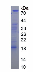 Recombinant Thrombin/Antithrombin Complex (TAT)