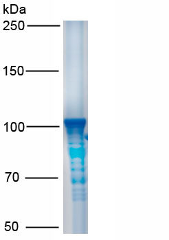 Recombinant Plasmin/Antiplasmin Complex (PAP)