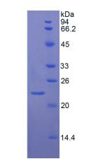 Recombinant Von Willebrand Factor (vWF)