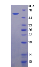 Recombinant Coagulation Factor X (F10)