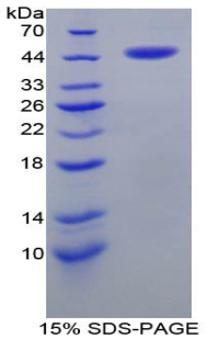 RPA835Hu01.jpg