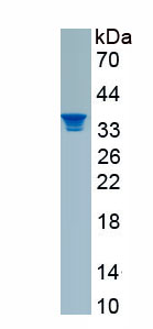 Recombinant Corticotropin Releasing Factor (CRF)