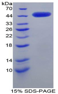 Recombinant Corticotropin Releasing Factor (CRF)